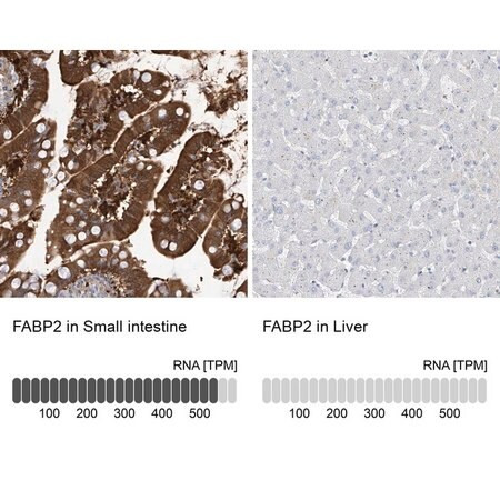 anti-fabp2 antibody produced in rabbit