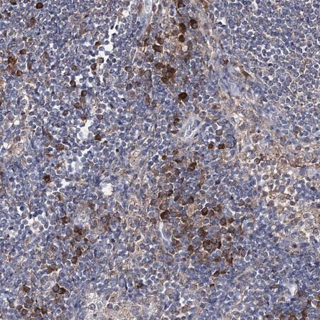 anti-il1rap antibody produced in rabbit