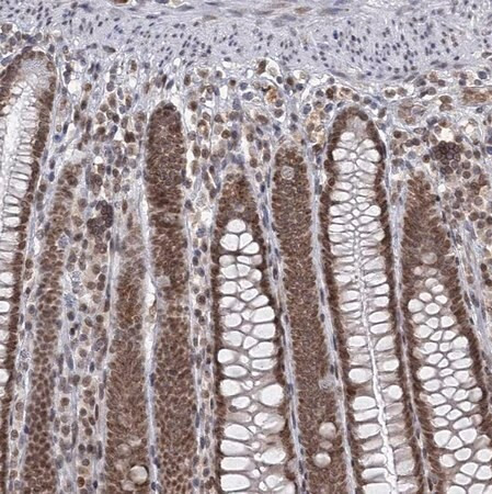 anti-trex1 antibody produced in rabbit (c15-1453-856)