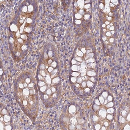 anti-eea1 antibody produced in rabbit (c15-1455-103)