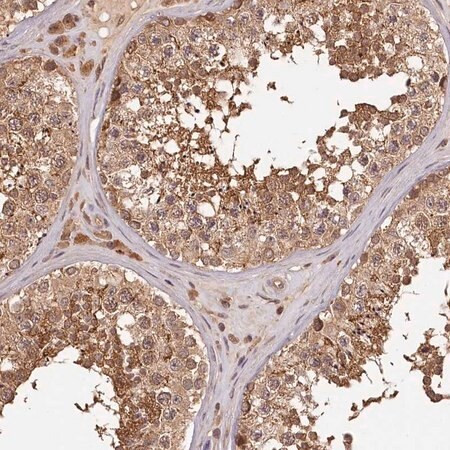 anti-ttc12 antibody produced in rabbit (c15-1455-309)