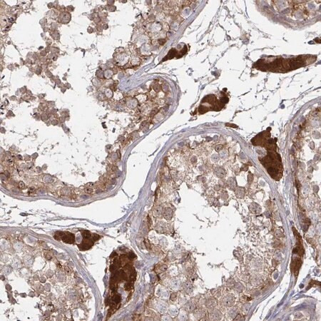 anti-ccs antibody produced in rabbit (c15-1456-026)
