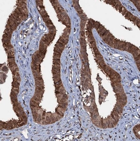 anti-hddc3 antibody produced in rabbit
