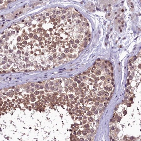 anti-prnt antibody produced in rabbit