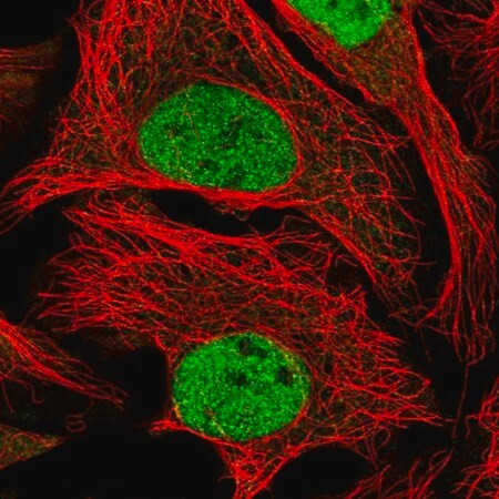 anti-wdr5 antibody produced in rabbit
