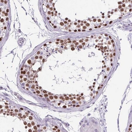 anti-vcx antibody produced in rabbit