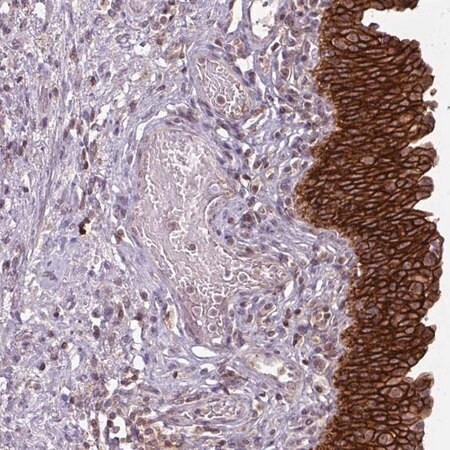 anti-tusc3 antibody produced in rabbit