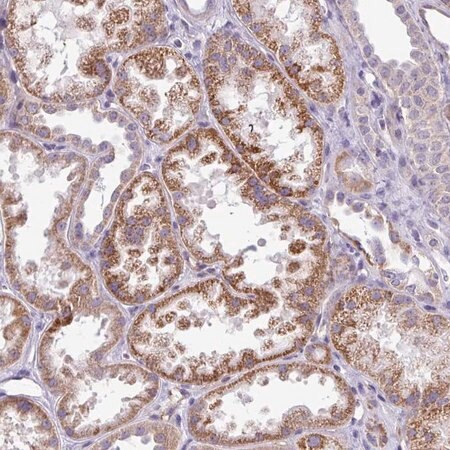 anti-aldh2 antibody produced in rabbit