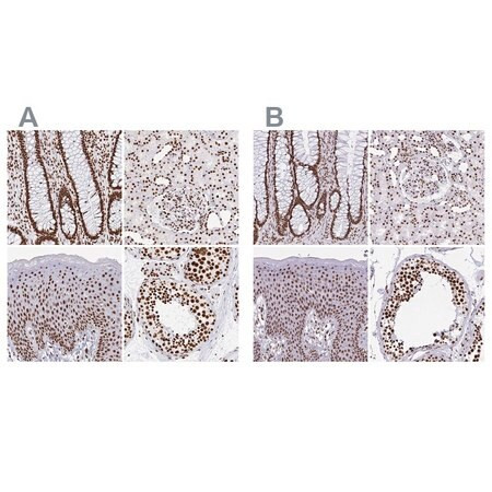 anti-ewsr1 antibody produced in rabbit (c15-1460-782)