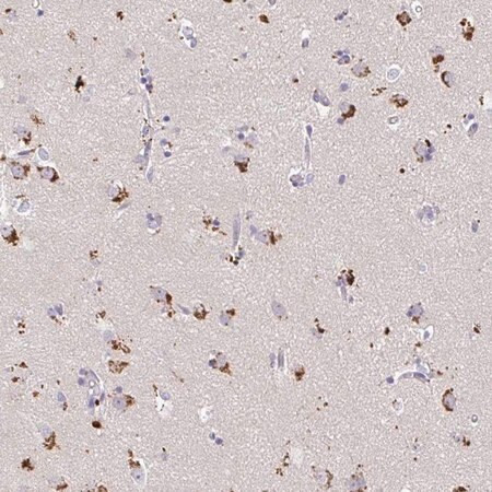 anti-map1lc3a antibody produced in rabbit (c15-1461-030)