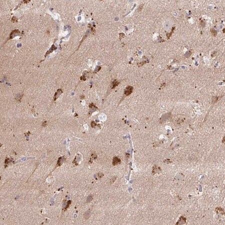 anti-map1lc3a antibody produced in rabbit (c15-1461-033)