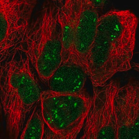 anti-tro antibody produced in rabbit (c15-1461-313)