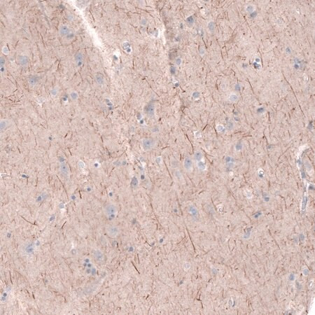 anti-ptprk antibody produced in rabbit (c15-1461-804)