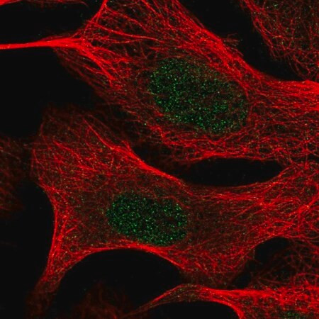 anti-tia1 antibody produced in rabbit