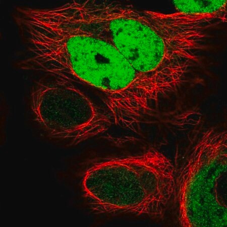 anti-fkbpl antibody produced in rabbit (c15-1463-465)