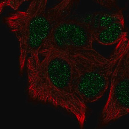 anti-kmt5b antibody produced in rabbit
