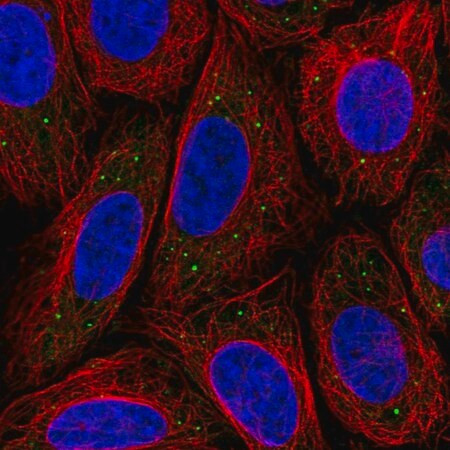 anti-med17 antibody produced in rabbit (c15-1464-589)