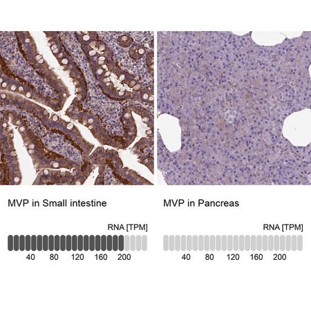 anti-mvp antibody produced in rabbit (c15-1464-716)