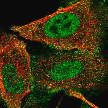 anti-gli1 antibody produced in rabbit (c15-1464-820)