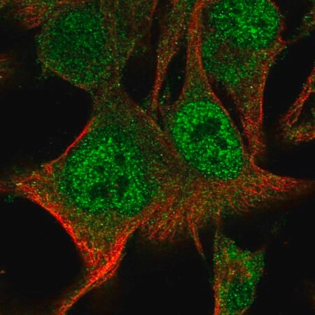 anti-parp9 antibody produced in rabbit