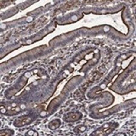 anti-dpp4 antibody produced in rabbit (c15-1465-538)