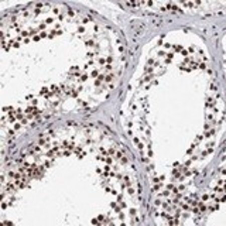 anti-rprd1b antibody produced in rabbit (c15-1465-870)