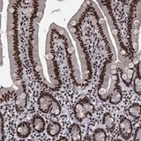 anti-rprd1b antibody produced in rabbit (c15-1466-251)