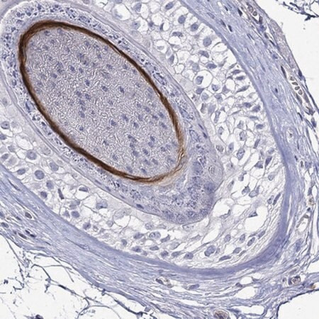 anti-krt40 antibody produced in rabbit
