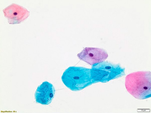 papanicolaou stain, og-6 (c15-1467-811)