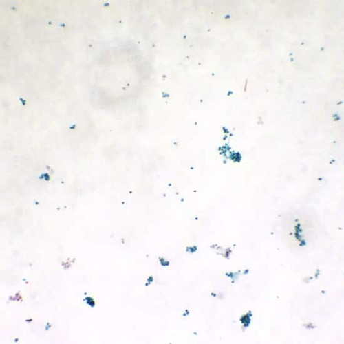 prepsld green algae