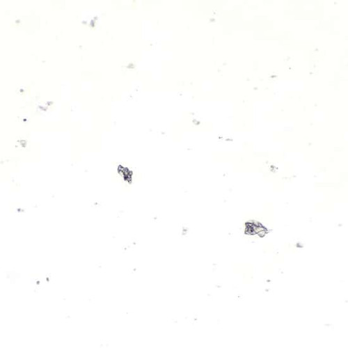 prepsld mixed diatoms wm