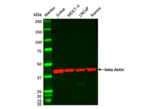 lncap whole cell lysate