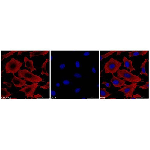 beta actin mouse mab (tritc)