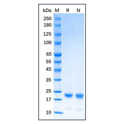 recombinant human cofilin protein (c09-1186-215)
