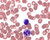 leishman's eosine methylene blue for microscopy