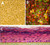 human epidermal keratinocytes: hek, fetal