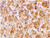 anti-darc antibody (c15-1317-625)