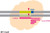 cas9 protein (c15-1347-178)