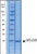 granulocyte-macrophage colony-stimulating factor human (c15-1425-691)