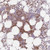 anti-ppm1a antibody produced in rabbit
