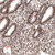 anti-setd2 antibody produced in rabbit (c15-1457-215)