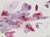 papanicolaou stain, ea 65