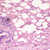 prepsld hmn lung tissue normal