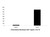 recombinant human ccl15 protein