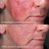 IMAGE Skincare Daily Prevention Advanced Smartblend Mineral Moisturizer SPF50+ 48g