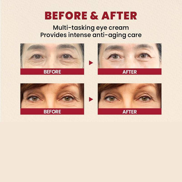 KSECRET SEOUL 1988 Eye Cream - Retinal Liposome 4% + Fermented Bean 30ml 2