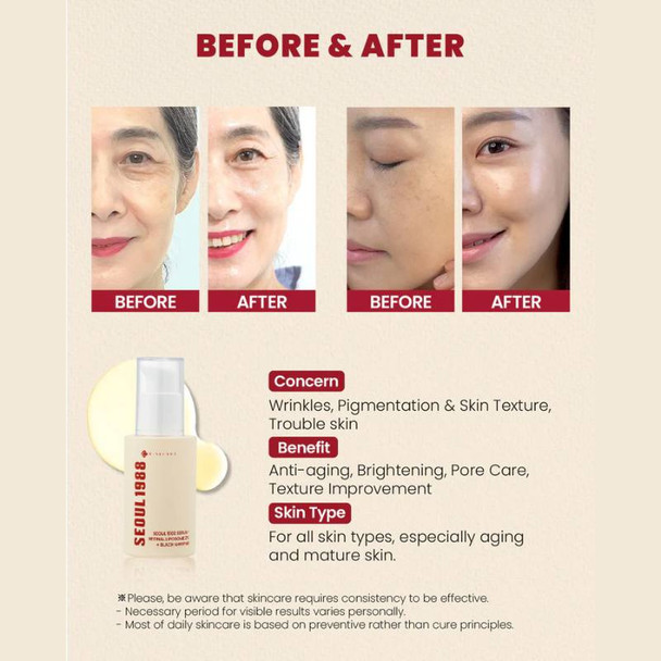 KSECRET SEOUL 1988 Serum - Retinal Liposome 2% + Black Ginseng 30ml 3 KSECRET SEOUL 1988 Serum - Retinal Liposome 2% + Black Ginseng 30ml 3