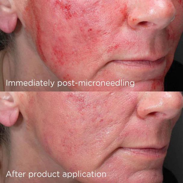 IMAGE Skincare Daily Prevention Advanced Smartblend Mineral Moisturizer SPF50+ 48g
