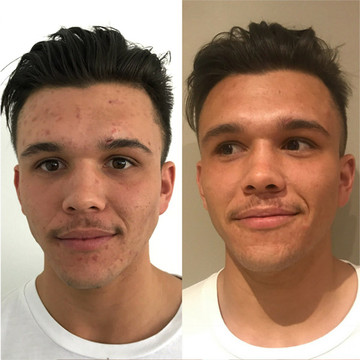 Organic Super Citrus Cleanser: 175ml Pump