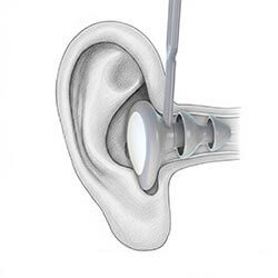pod-earseal-earplugs-ear-canal-fit.jpg